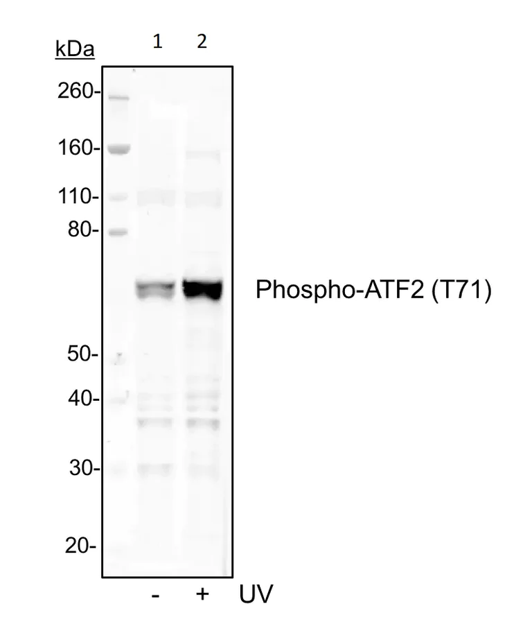 Western blot - Anti-ATF2 (phospho T71) antibody [ATF2T71-G3] (AB278689)