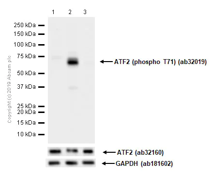 Western blot - Anti-ATF2 (phospho T71) antibody [E268] (AB32019)