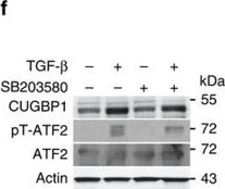 Western blot - Anti-ATF2 (phospho T71) antibody [E268] (AB32019)