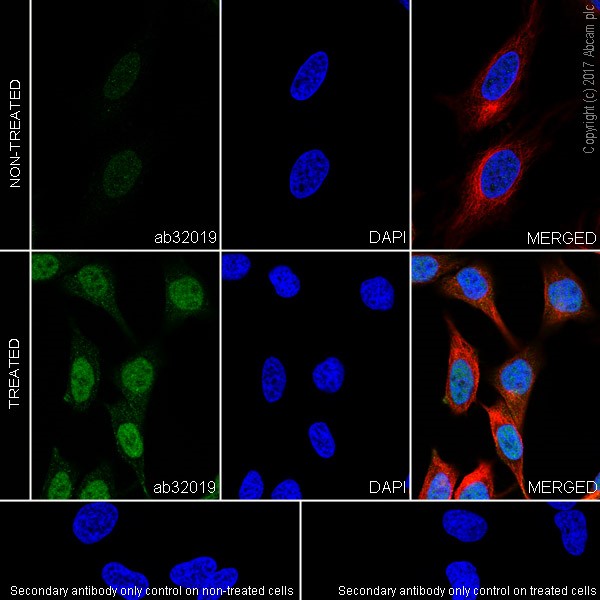 Immunocytochemistry/ Immunofluorescence - Anti-ATF2 (phospho T71) antibody [E268] - BSA and Azide free (AB242381), expandable thumbnail
