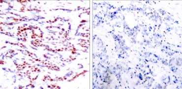 Immunohistochemistry (Formalin/PFA-fixed paraffin-embedded sections) - Anti-ATF2 (phospho T71 + T53) antibody (AB28812), expandable thumbnail