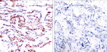 Immunohistochemistry (Formalin/PFA-fixed paraffin-embedded sections) - Anti-ATF2 (phospho T71 + T53) antibody (AB28812)