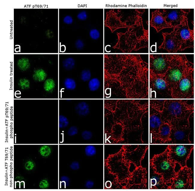 Immunocytochemistry - Anti-ATF2 (phospho Y69 + T71) antibody [24HCLC] (AB277776)