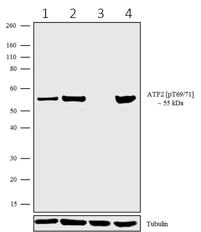 Western blot - Anti-ATF2 (phospho Y69 + T71) antibody [24HCLC] (AB277776)