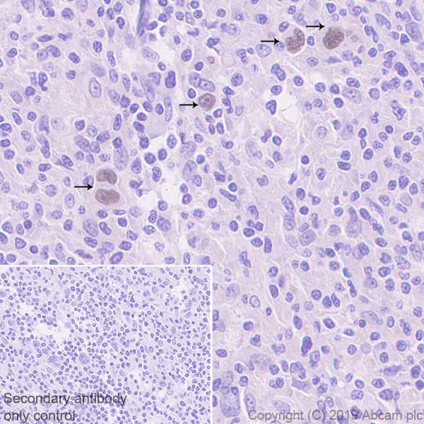 Immunohistochemistry (Formalin/PFA-fixed paraffin-embedded sections) - Anti-ATF3 antibody [EPR22610-19] - ChIP Grade (ab254268), expandable thumbnail