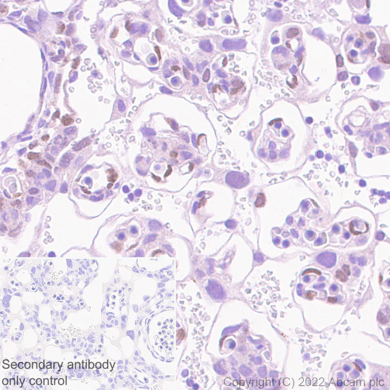 Immunohistochemistry (Formalin/PFA-fixed paraffin-embedded sections) - Anti-ATF3 antibody [EPR25413-65] (AB305293)