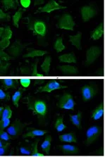 Immunocytochemistry/ Immunofluorescence - Anti-ATF6 antibody [1-7] (AB122897)