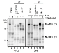 Immunoprecipitation - Anti-ATF6 antibody [1-7] (AB122897)