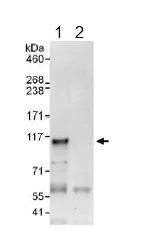 Immunoprecipitation - Anti-ATF6 antibody (AB134561)