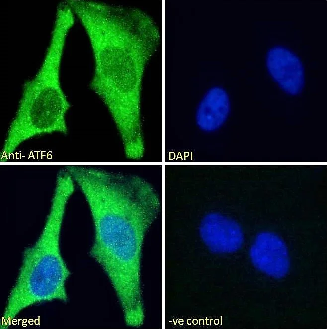 Immunocytochemistry - Anti-ATF6 antibody (AB174756)