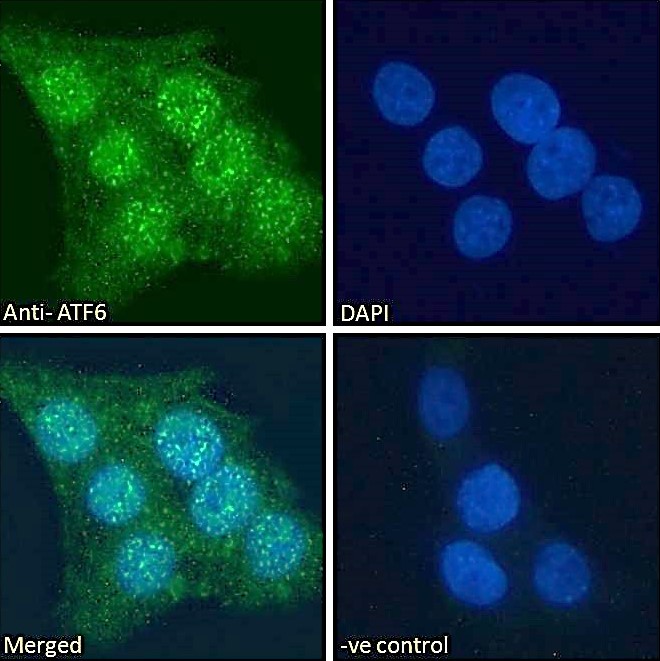 Immunocytochemistry - Anti-ATF6 antibody (AB174756)