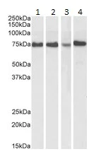 Western blot - Anti-ATF6 antibody (AB174756)