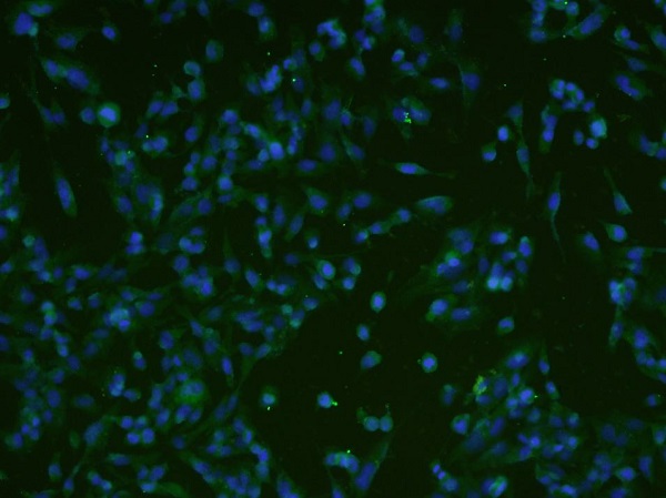 Immunocytochemistry/ Immunofluorescence - Anti-ATF6 antibody (AB203119)
