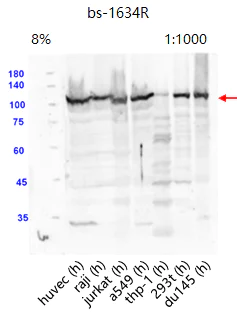Western blot - Anti-ATF6 antibody (AB203119)