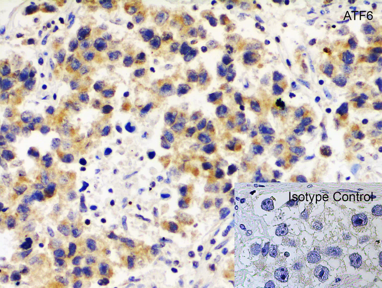 Immunohistochemistry (Formalin/PFA-fixed paraffin-embedded sections) - Anti-ATF6 antibody (AB37149)