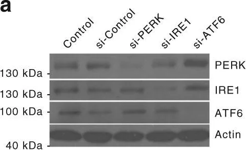 Western blot - Anti-ATF6 antibody (AB37149)