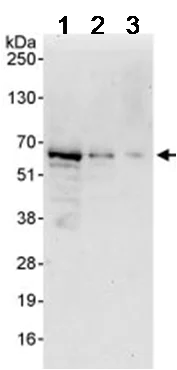 Western blot - Anti-ATF7 antibody (AB87844)