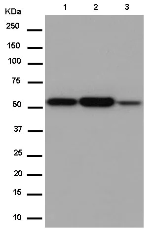 Western blot - Anti-ATF7 antibody [EPR13556] (AB183507)