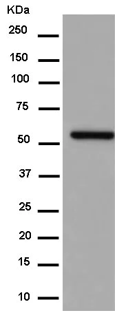 Western blot - Anti-ATF7 antibody [EPR13556] (AB183507)