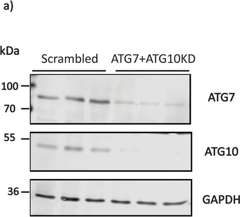 Western blot - Anti-ATG10 antibody [EPR4804] (AB124711)