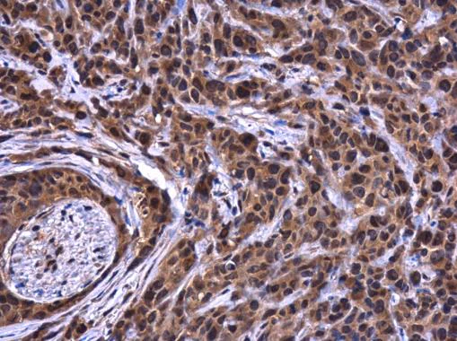 Immunohistochemistry (Formalin/PFA-fixed paraffin-embedded sections) - Anti-ATG101 antibody (AB229235)