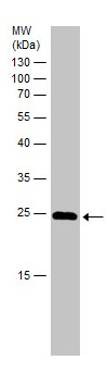 Western blot - Anti-ATG101 antibody (AB229235)