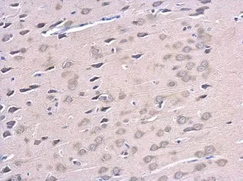 Immunohistochemistry (Formalin/PFA-fixed paraffin-embedded sections) - Anti-ATG12 antibody (AB155589)