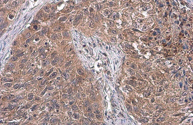 Immunohistochemistry (Formalin/PFA-fixed paraffin-embedded sections) - Anti-ATG12 antibody (AB155589)