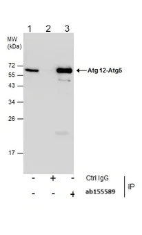 Immunoprecipitation - Anti-ATG12 antibody (AB155589)