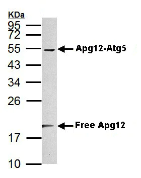 Western blot - Anti-ATG12 antibody (AB155589)