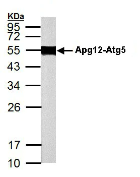 Western blot - Anti-ATG12 antibody (AB155589)