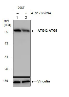 Western blot - Anti-ATG12 antibody (AB155589)