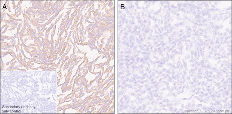 Immunohistochemistry (Formalin/PFA-fixed paraffin-embedded sections) - Anti-ATG12 antibody [EPR27485-89] - BSA and Azide free (AB303489)