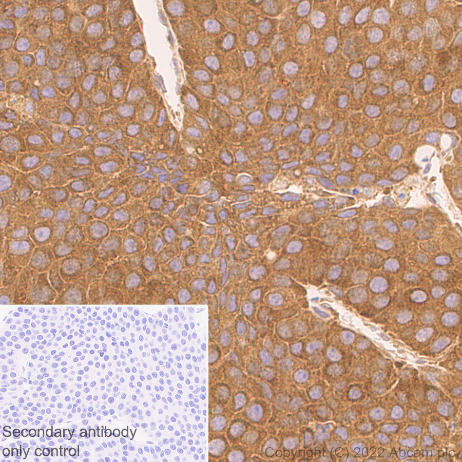 Immunohistochemistry (Formalin/PFA-fixed paraffin-embedded sections) - Anti-ATG12 antibody [EPR27485-89] - BSA and Azide free (ab303489), expandable thumbnail