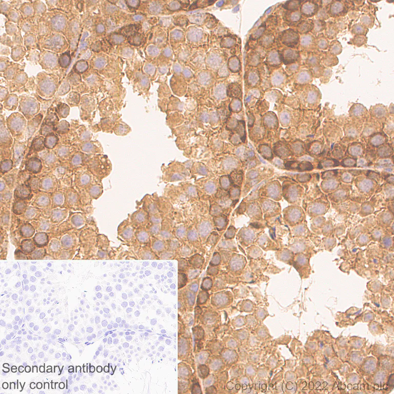 Immunohistochemistry (Formalin/PFA-fixed paraffin-embedded sections) - Anti-ATG12 antibody [EPR27485-89] - BSA and Azide free (AB303489)