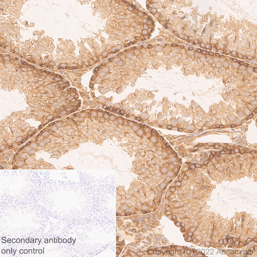 Immunohistochemistry (Formalin/PFA-fixed paraffin-embedded sections) - Anti-ATG12 antibody [EPR27485-89] - BSA and Azide free (AB303489), expandable thumbnail