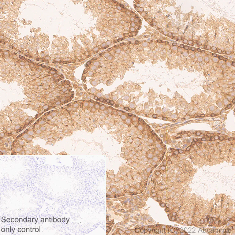 Immunohistochemistry (Formalin/PFA-fixed paraffin-embedded sections) - Anti-ATG12 antibody [EPR27485-89] - BSA and Azide free (AB303489)