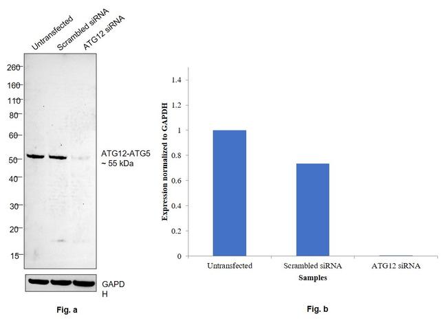 Western blot - Anti-ATG12 antibody [RP23040104] (AB313434), expandable thumbnail