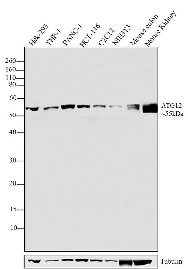 Western blot - Anti-ATG12 antibody [RP23040104] (AB313434), expandable thumbnail