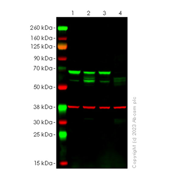 Western blot - Anti-ATG14 antibody [EPR26188-66] - BSA and Azide free (AB315010), expandable thumbnail