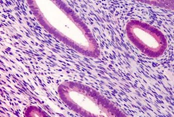 Immunohistochemistry (Formalin/PFA-fixed paraffin-embedded sections) - Anti-ATG16L1 antibody (AB188642)