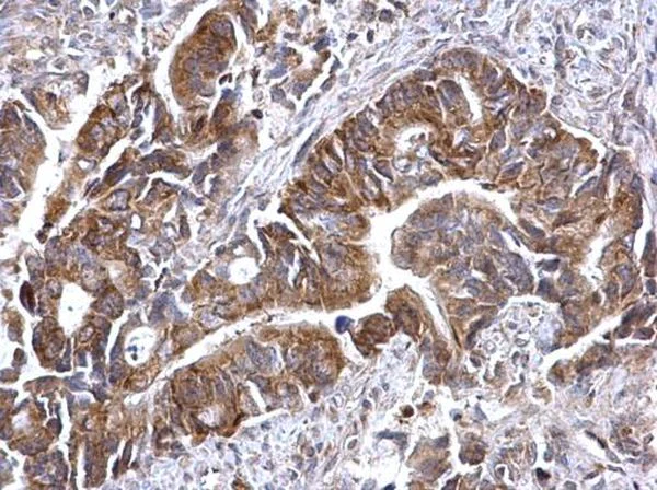 Immunohistochemistry (Formalin/PFA-fixed paraffin-embedded sections) - Anti-ATG16L1 antibody (AB227714)