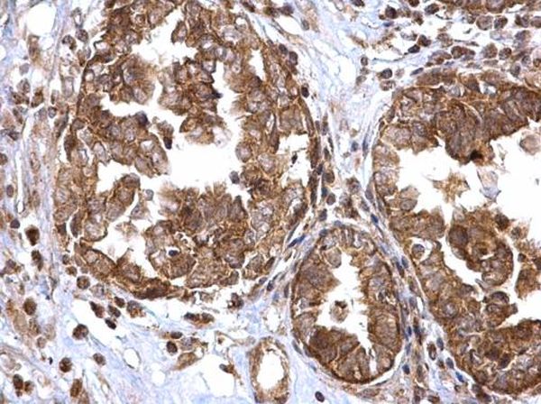 Immunohistochemistry (Formalin/PFA-fixed paraffin-embedded sections) - Anti-ATG16L1 antibody (AB227714)