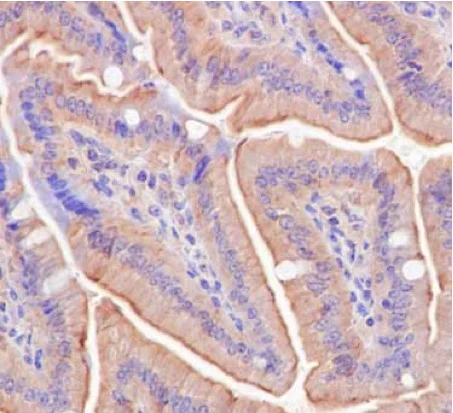 Immunohistochemistry (Formalin/PFA-fixed paraffin-embedded sections) - Anti-ATG16L1 antibody [EPR15638] - N-terminal (AB187671)