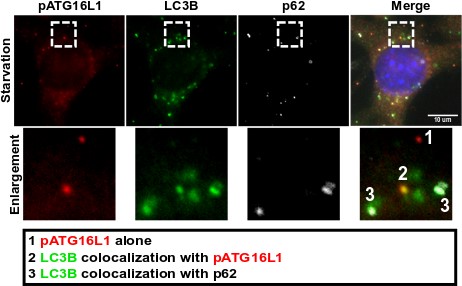 Immunocytochemistry/ Immunofluorescence - Anti-ATG16L1 (phospho S278) antibody [EPR19016] (AB195242), expandable thumbnail