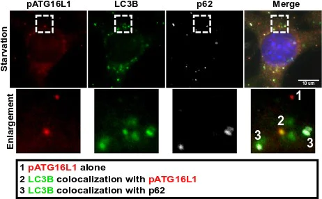 Immunocytochemistry/ Immunofluorescence - Anti-ATG16L1 (phospho S278) antibody [EPR19016] (AB195242)