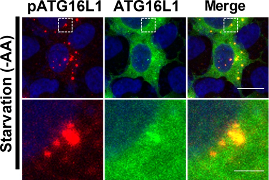 Immunocytochemistry/ Immunofluorescence - Anti-ATG16L1 (phospho S278) antibody [EPR19016] (AB195242), expandable thumbnail