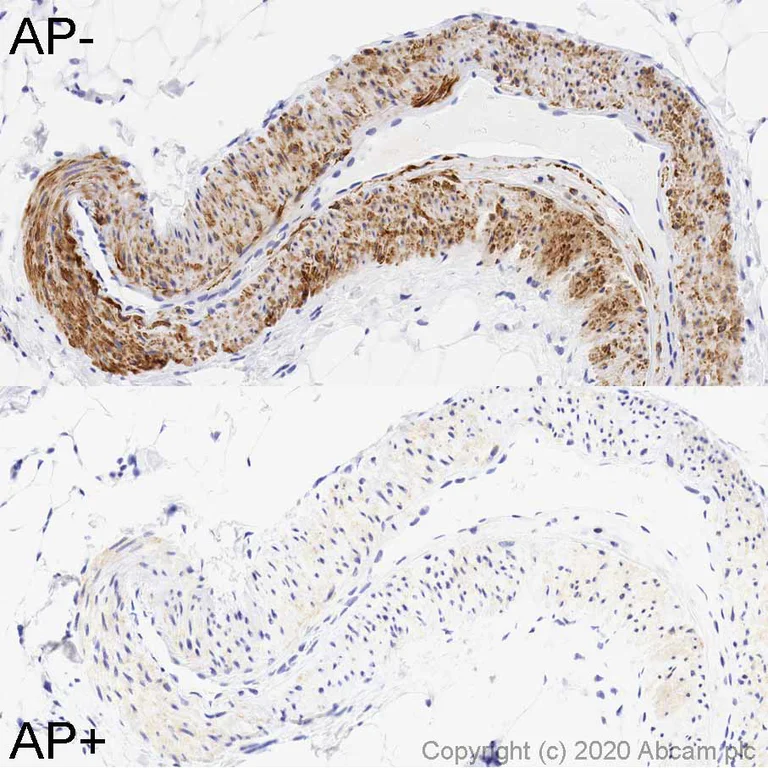 Immunohistochemistry (Formalin/PFA-fixed paraffin-embedded sections) - Anti-ATG16L1 (phospho S278) antibody [EPR19016] (AB195242)