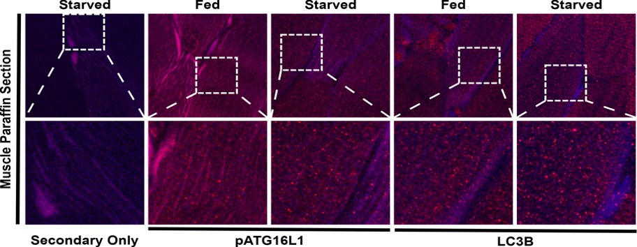 Immunohistochemistry (Formalin/PFA-fixed paraffin-embedded sections) - Anti-ATG16L1 (phospho S278) antibody [EPR19016] (AB195242), expandable thumbnail