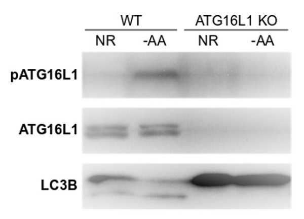 Western blot - Anti-ATG16L1 (phospho S278) antibody [EPR19016] (AB195242), expandable thumbnail